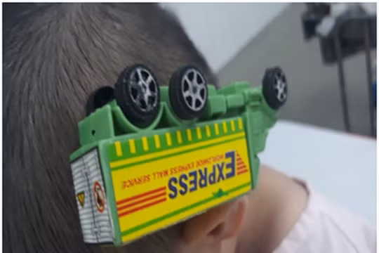 Bất ngờ té ngã, bé trai bị xe đồ chơi cắm vào đầu