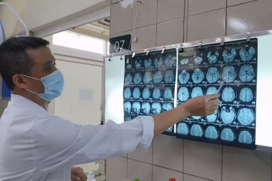 6 người nhiễm độc thiếc ở Hải Dương: Trường hợp nặng bị tâm thần, tử vong