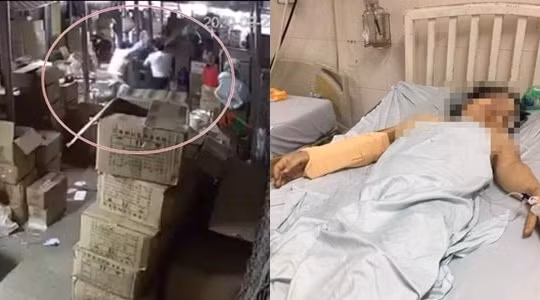 Bắt tạm giam gã đàn ông bạo hành vợ cũ