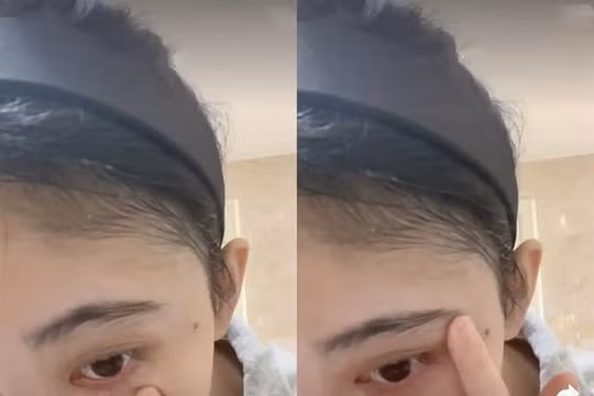 Cúc Tịnh Y lộ bằng chứng "dao kéo" trong clip rửa mặt nhưng không dám chạm vào mũi?