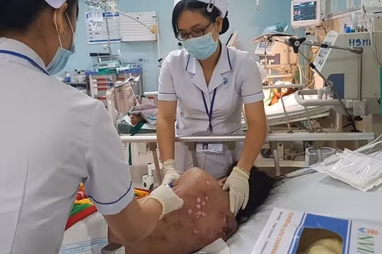 Đồng Nai: Bắt khẩn cấp chủ quán cà phê đánh nữ nhân viên vì không chịu “đi khách”