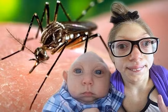 Virus Zika nguy hiểm như nào đối với phụ nữ có thai