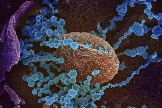 Mã gien virus SARS-CoV-2 gây bệnh ở Hải Dương và Đà Nẵng giống nhau