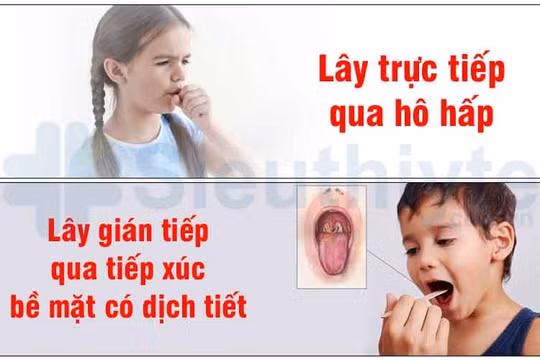 TP.HCM: Yêu cầu tăng cường phòng, chống bệnh bạch hầu trong trường học