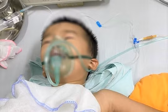 Thanh Hóa: Bé trai 4 tuổi bị trâu húc thủng phổi