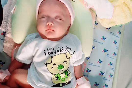Mổ tách cặp song sinh dính liền Trúc Nhi - Diệu Nhi phức tạp ra sao?