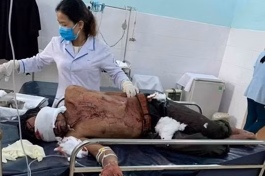 Thông tin mới nhất vụ người đàn ông bị gấu rừng tấn công ở Quảng Nam