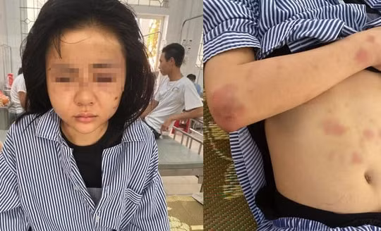 Triệu tập kẻ hành hung cô gái suốt 2 giờ ở Yên Bái