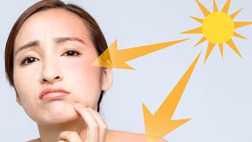 vitamin e va nhung tac dung tuyet voi doi voi lan da hinh 1