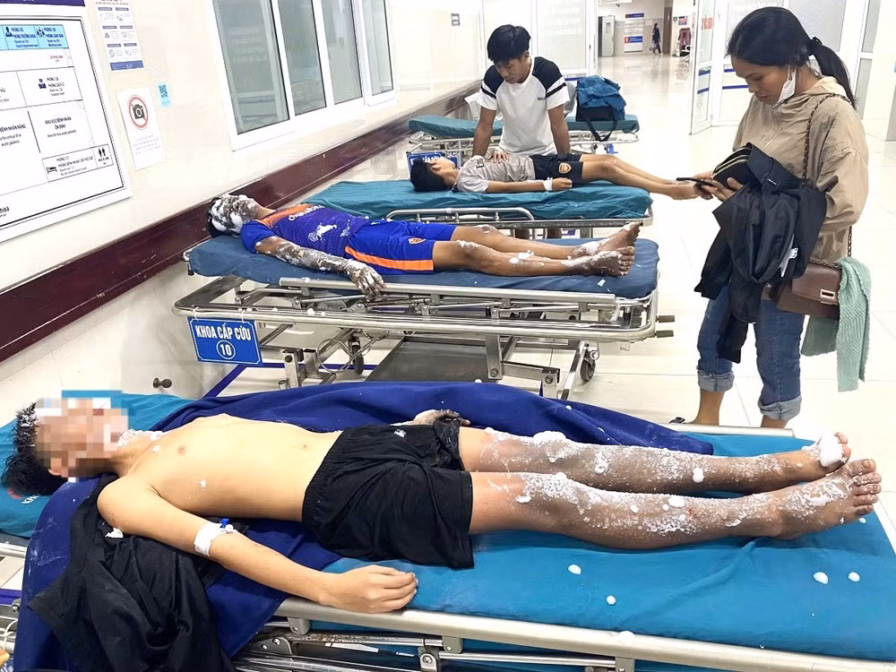tai nan phao no tang cao mot nam sinh vua mat vinh vien cac ngon tay hinh 1