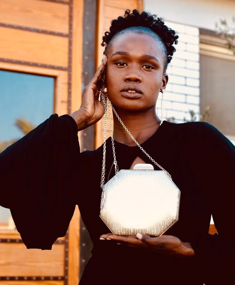 hoa hau nam sudan bi sat hai qua doi o tuoi 26 hinh 1