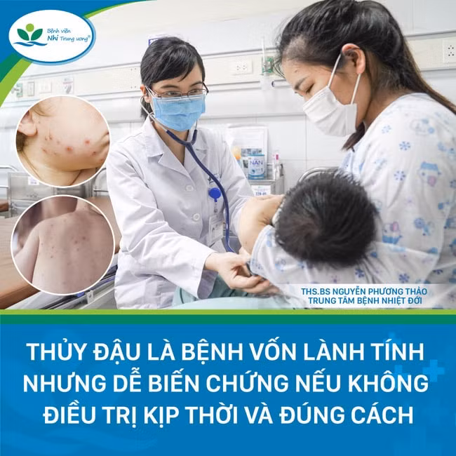 benh thuy dau vao mua cha me khong duoc chu quan hinh 1