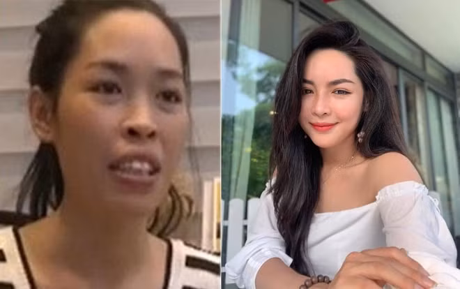 Từ diện mạo kém xinh xắn, tự ti khi làm việc trong lĩnh vực thời trang, cô gái 28 tuổi như trở thành người khác sau khi dao kéo.