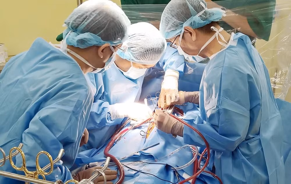 28000 ong thuoc chong dong mau dung trong mo tim duoc chuyen den cac benh vien hinh 1