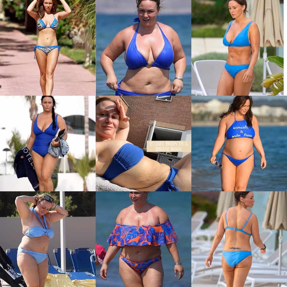 chanelle hayes bo cu cua balotelli va ronaldo giam 57kg nho phau thuat hinh 2
