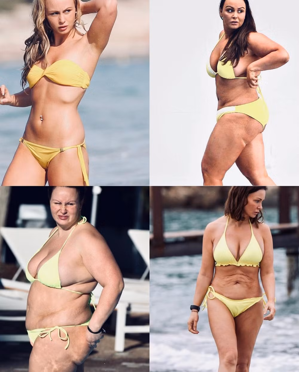 chanelle hayes bo cu cua balotelli va ronaldo giam 57kg nho phau thuat hinh 3