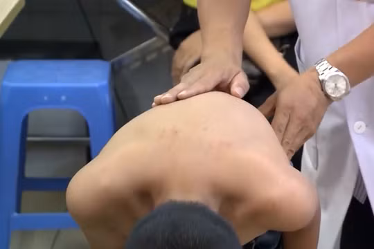 Cong vẹo cột sống: Khi một bệnh lý có thể tác động đến nhiều cơ quan trong cơ thể