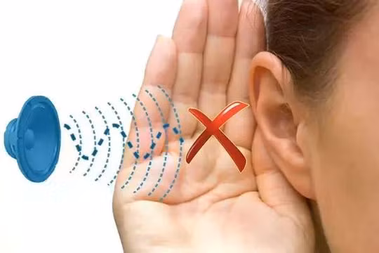 Mất thính lực bất ngờ: Đừng chủ quan với triệu chứng ù tai, nghe kém