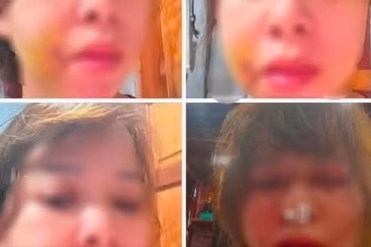 Đắk Lắk: Người phụ nữ đăng clip tố bị chồng đánh đập, công an vào cuộc
