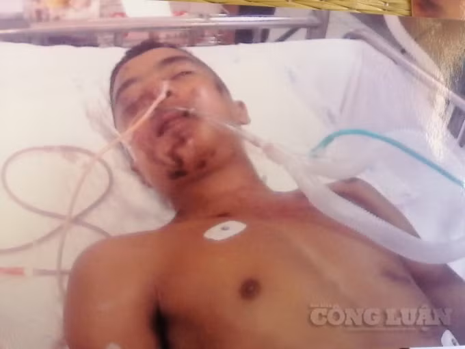 vu tngt tai dong hoi co quan csdt cong an tp dong hoi co dau hieu vi pham to tung nghiem trong hinh 1