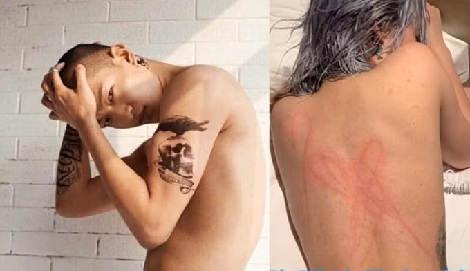 Khuất Sở Tiêu bị tình cũ tố có sở thích tình dục lạ đời và bệnh hoạn.