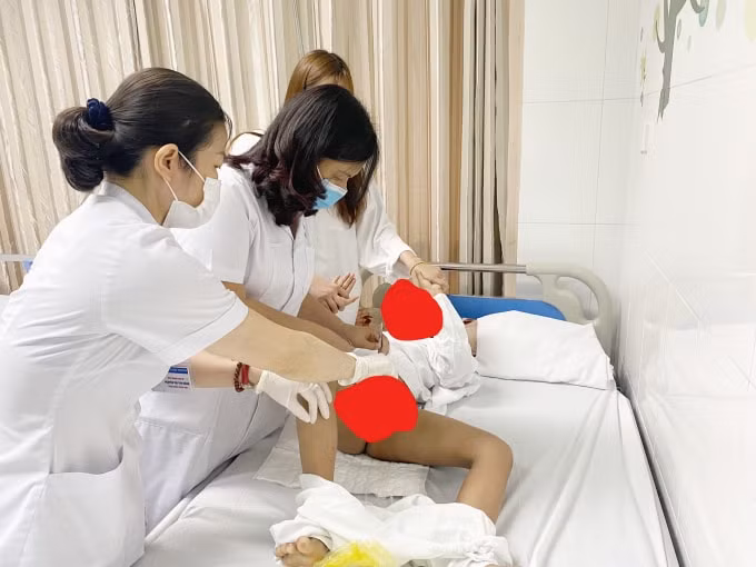 Hàng năm vẫn thường xảy ra việc trẻ bị chó tấn công gây thương tích nặng (ảnh TL).
