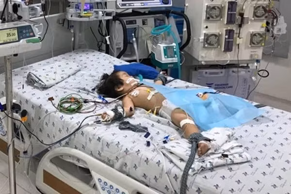 Bé gái 15 tháng tuổi đang được bác sĩ điều trị tích cực tại Bệnh viện Nhi đồng Thành phố (TP. HCM). Ảnh: 2sao.vn