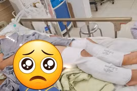 Mưa bão: Gia tăng số ca bị thương do rắn và các động vật khác có nọc độc cắn