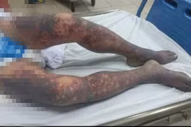 Ăn Tiết canh tất niên, một người tử vong