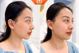 Bí quyết cho nhan sắc rạng ngời - Làm đẹp toàn diện cùng Thẩm mỹ DrD 