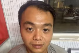 Bắt đối tượng cầm cuốc phang con nợ trọng thương