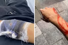 Nhóm đối tượng dùng dao chém, cướp xe máy ngay tại Hà Nội
