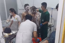Bình Dương: Nổ lớn ở công ty gỗ, nhiều công nhân bỏng nặng