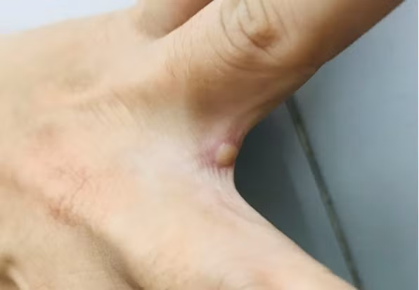 tp hcm co ca dau mua khi thu 2 hinh 1