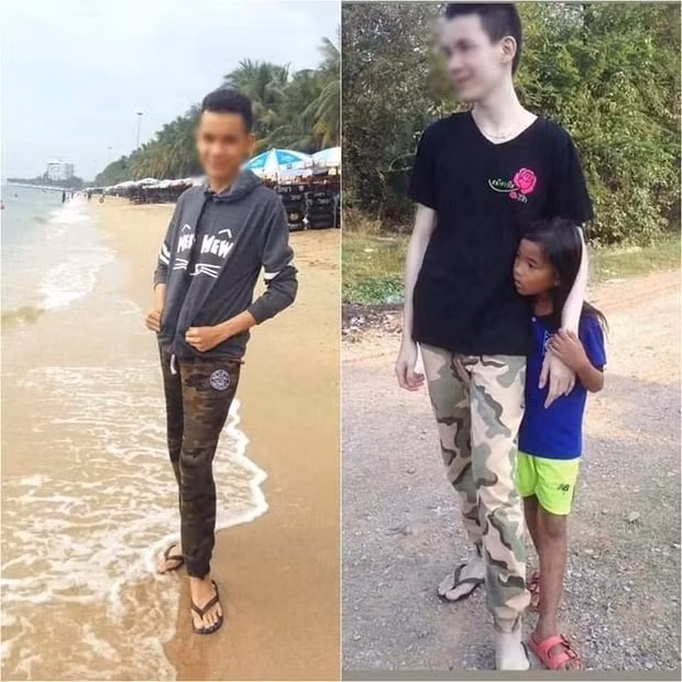 Màu da trông y hệt tông màu thường xuất hiện trên da của các thi thể.