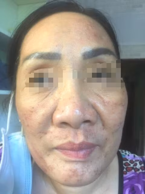 Hình 3