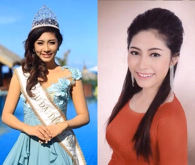 Hàm răng khi đăng quang của mỹ nhân gốc Cần Thơ không đều gây ảnh hưởng đến nụ cười của cô.