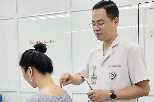 Y học cổ truyền kết hợp công nghệ hiện đại mở thêm lựa chọn cho người đau cổ vai gáy