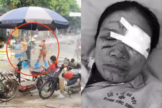 Vụ người bán rau bị xịt vòi cao áp vào mặt ở Phú Thọ: Mắt vẫn sưng nề, chưa thể đánh giá thị lực