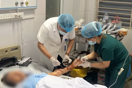 Đáng chú ý, một vết cắn ở cẳng tay gây tổn thương sâu, dẫn đến gãy hở xương quay. Ảnh: BVCC