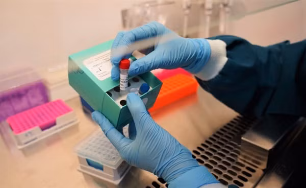 Để đảm bảo an toàn, các xét nghiệm virus SARS-CoV-2 với sinh phẩm VinKit sẽ được thực hiện trong phòng xét nghiệm đạt tiêu chuẩn an toàn sinh học cấp 2.