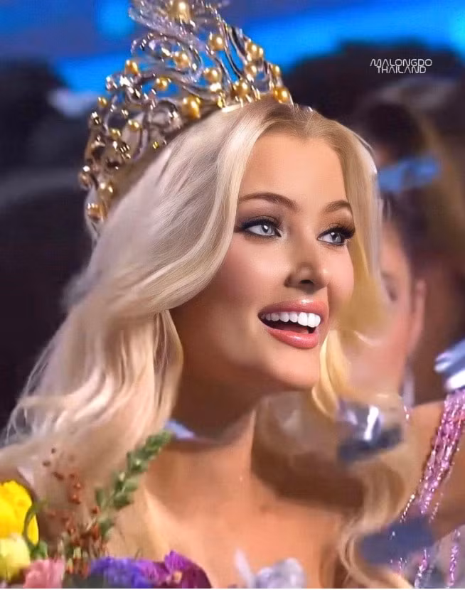 chiem nguong nhan sac nhu bup be cua tan miss universe 2024 hinh 2