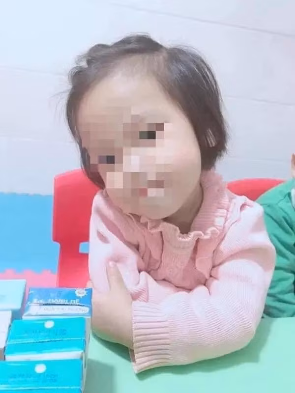 be gai 3 tuoi bi dong dinh vao dau da tu vong hinh 1