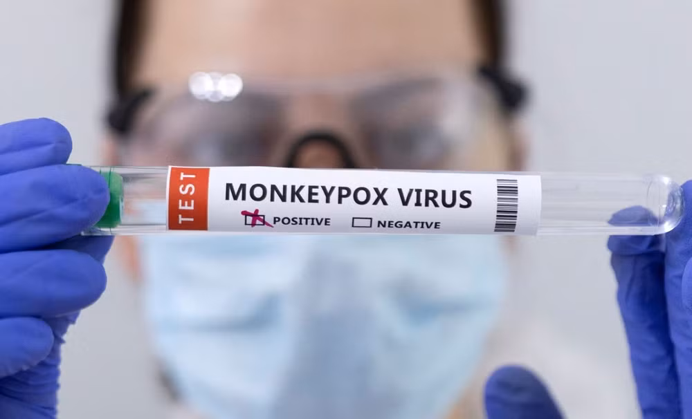 who tuyen bo benh mpox khong con la tinh trang khan cap ve suc khoe cong dong hinh 1