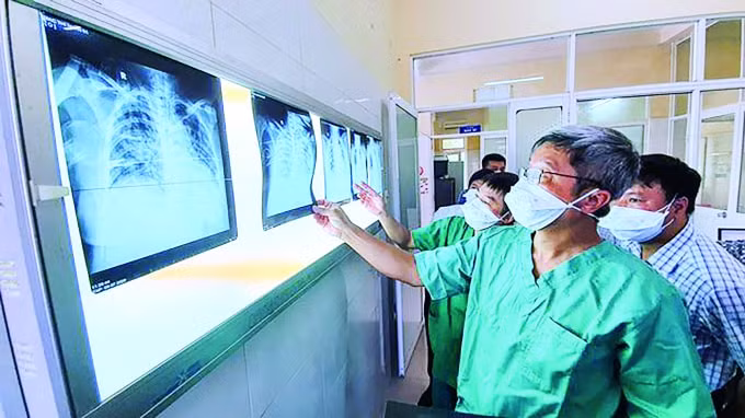 Thứ trưởng Nguyễn Trường Sơn kiểm tra phim chụp của bệnh nhân tại BV Phổi Đà Nẵng.