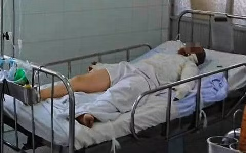 Nạn nhân bị thương nặng ở vùng mặt do sức nổ quá lớn. Ảnh TL.