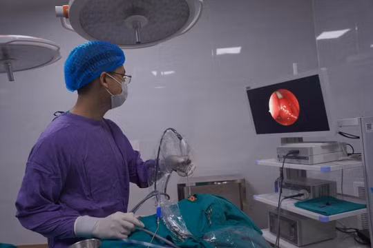 Chiếc răng mọc lạc trong hốc mũi của bệnh nhi 8 tuổi