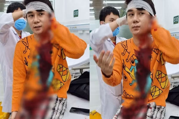 bat nghi pham chem trong thuong nam dien vien phim thuong ngay nang ve hinh 1