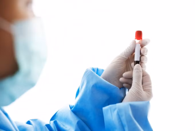 vi sao vaccine covid 19 se dan dao thai khoi co the sau khi tiem 1 thoi gian hinh 1