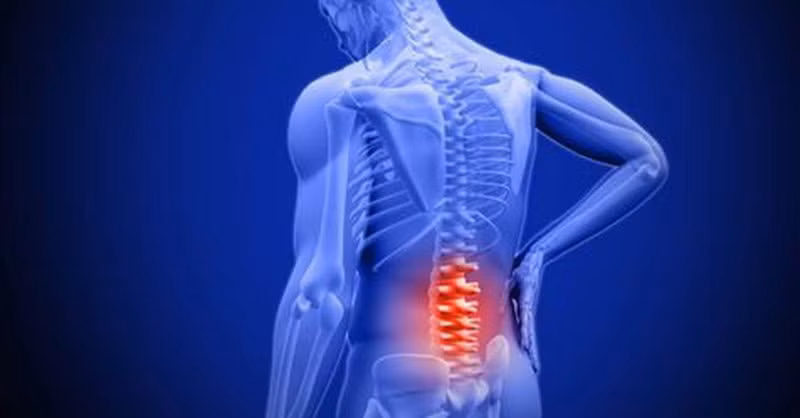 Viêm khớp cột sống dù không gây đau thì người bệnh vẫn có thể cảm thấy cứng khớp. Ảnh: internet.